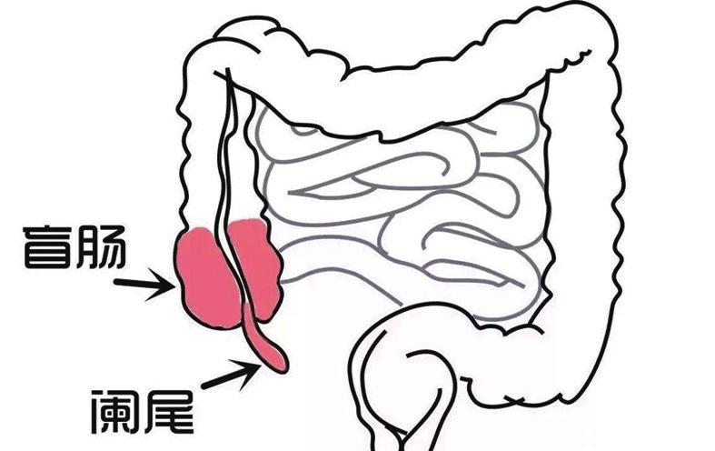 阑尾由阑尾动脉作为单一血供,一旦发生闭塞,容易出现坏疽性